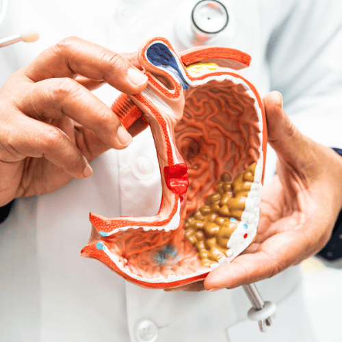 gastrocirujano-cdmx-clinica-ouch